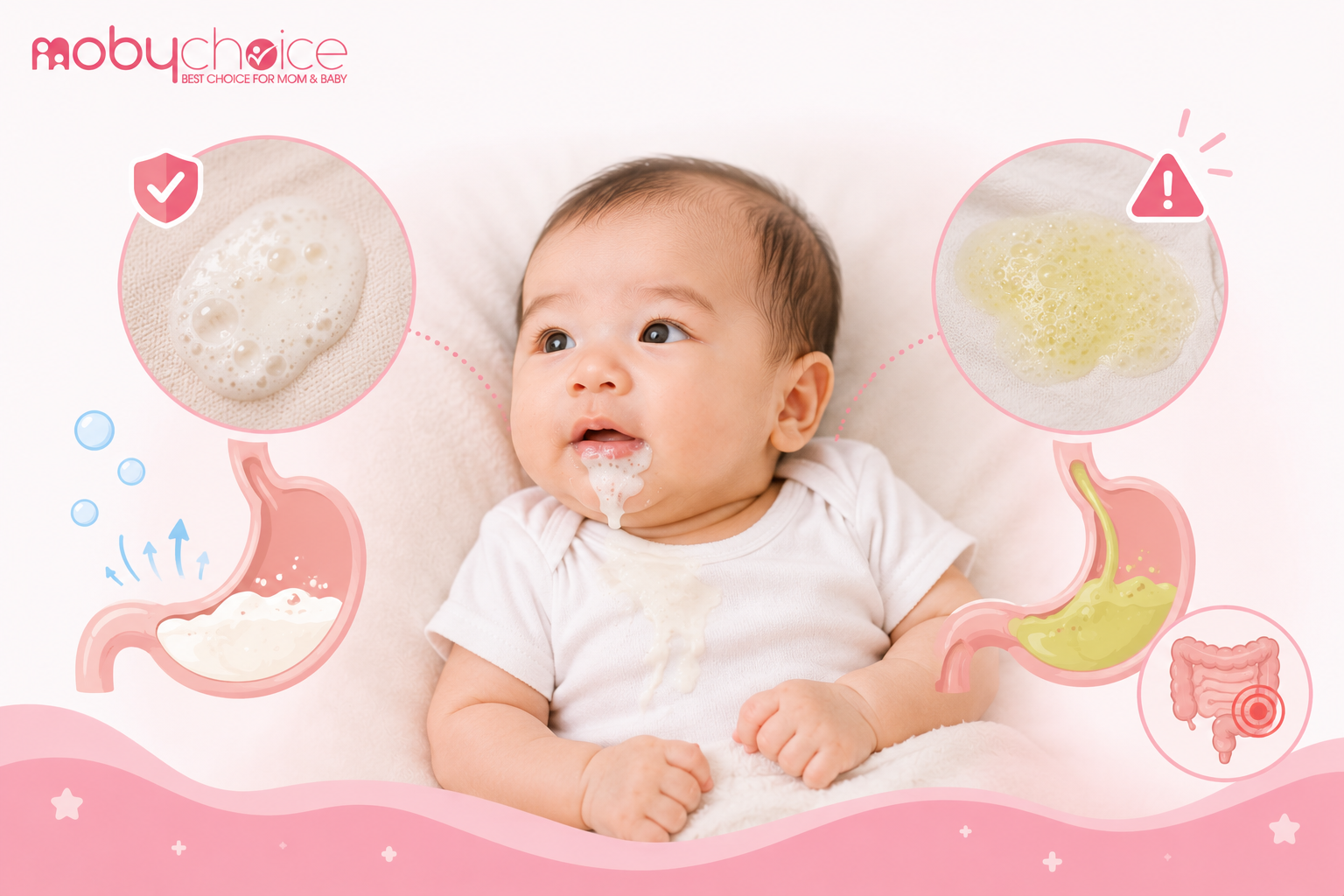 trẻ sơ sinh bị trào ngược sữa